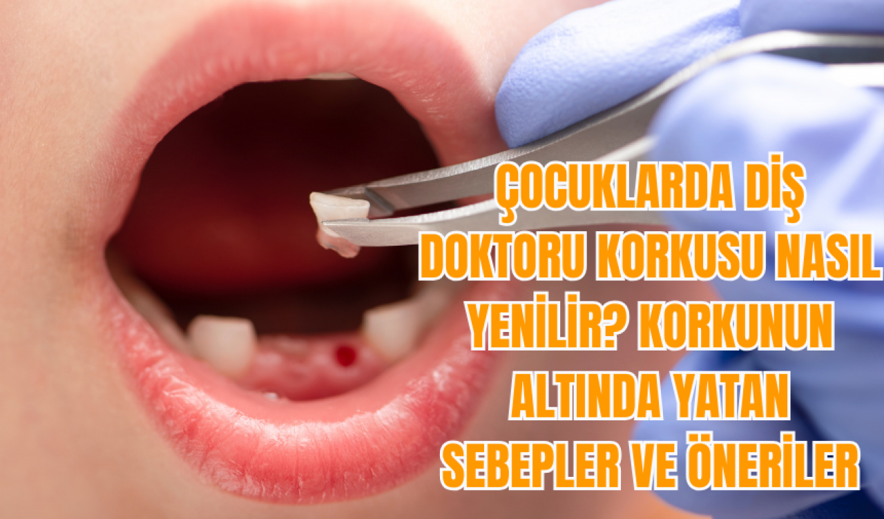 Çocuklarda diş doktoru korkusu nasıl yenilir? Korkunun altında yatan sebepler ve öneriler