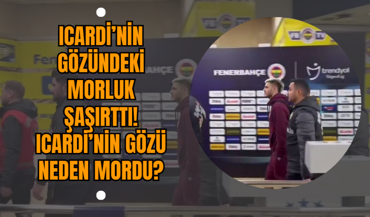 Icardi’nin Gözündeki Morluk Şaşırttı! Icardi’nin Gözü Neden Mordu?