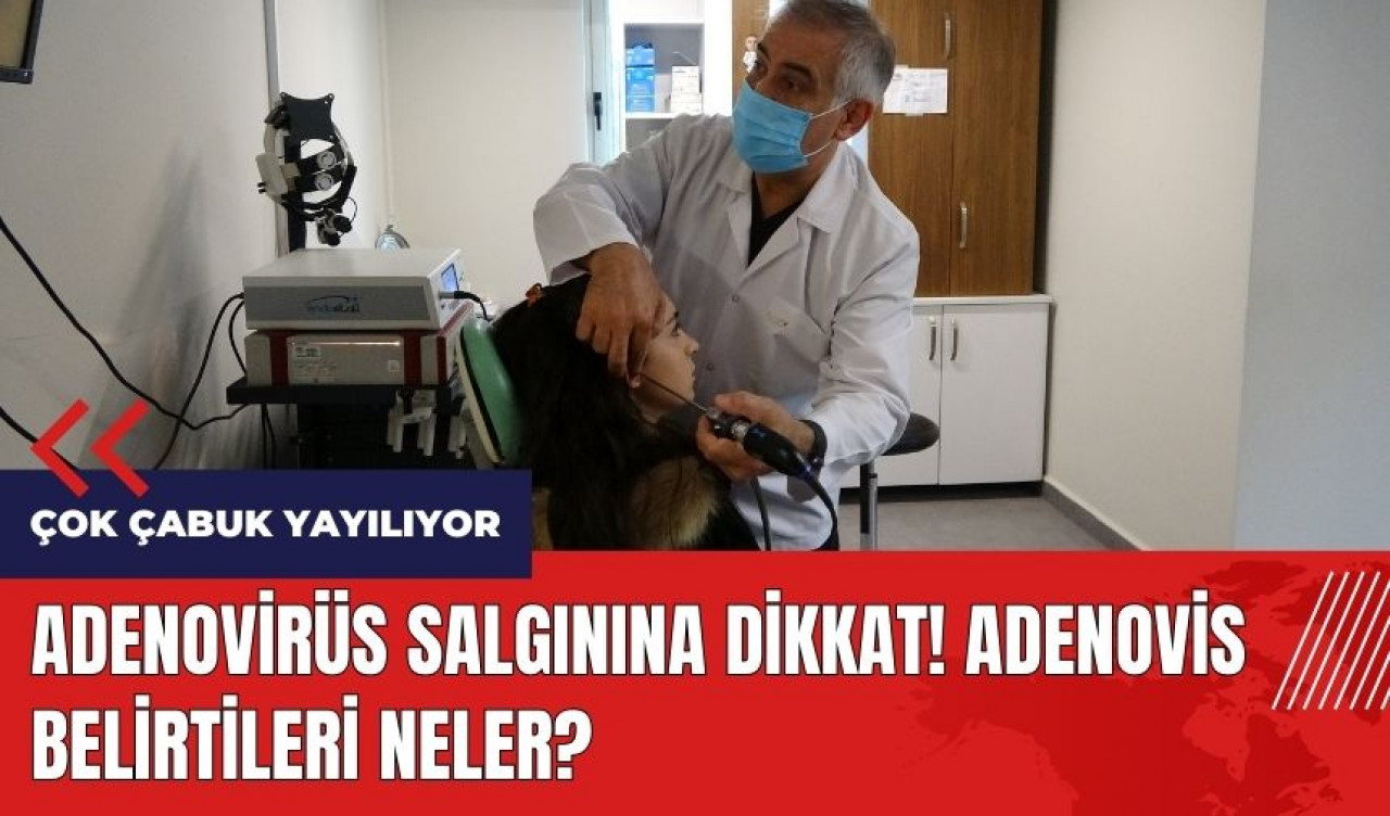 Adenovirüs salgınına dikkat! Adenovirüs belirtileri neler?