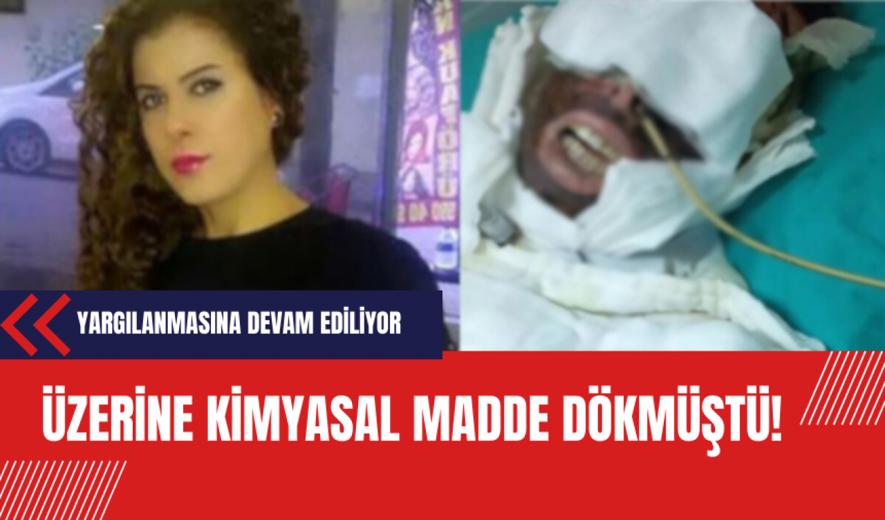 Kadının üzerine kimyasal madde dökmüştü! Yargılanmasına devam ediliyor!