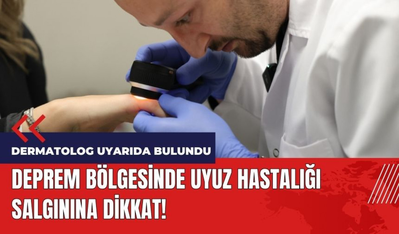 Deprem bölgesinde uyuz salgınına dikkat!