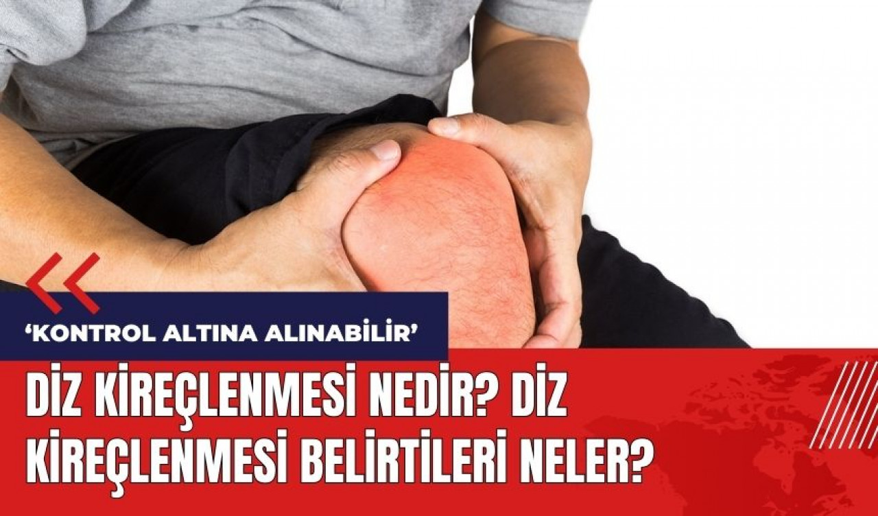 Diz kireçlenmesi nedir? Diz kireçlenmesi belirtileri neler?