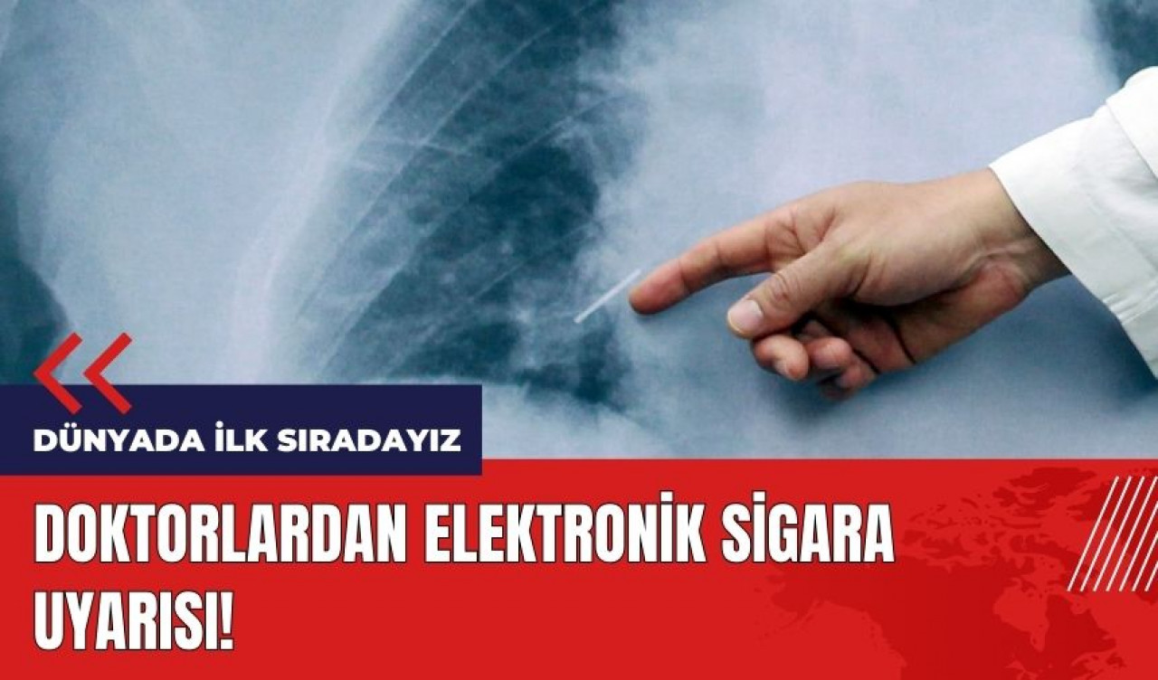 Dünyada ilk sıradayız! Doktorlardan elektronik sigara uyarısı