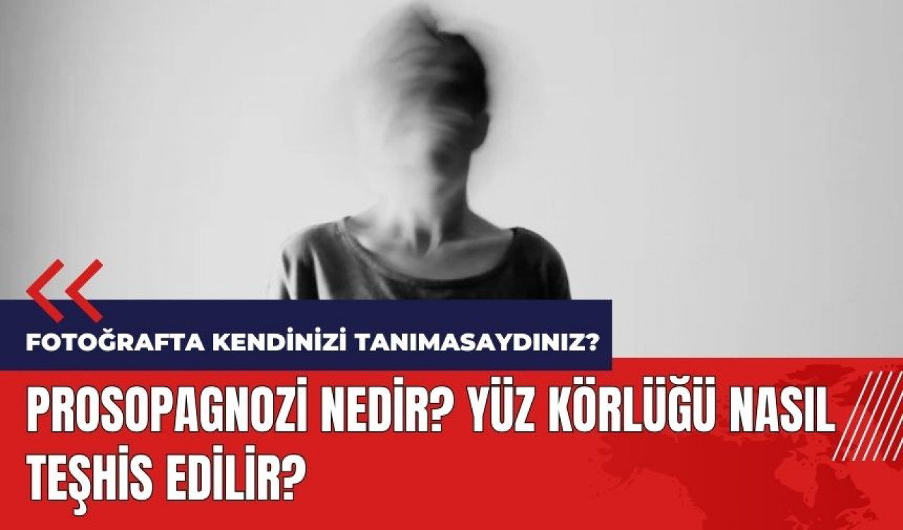 Prosopagnozi nedir? Yüz körlüğü nasıl teşhis edilir?