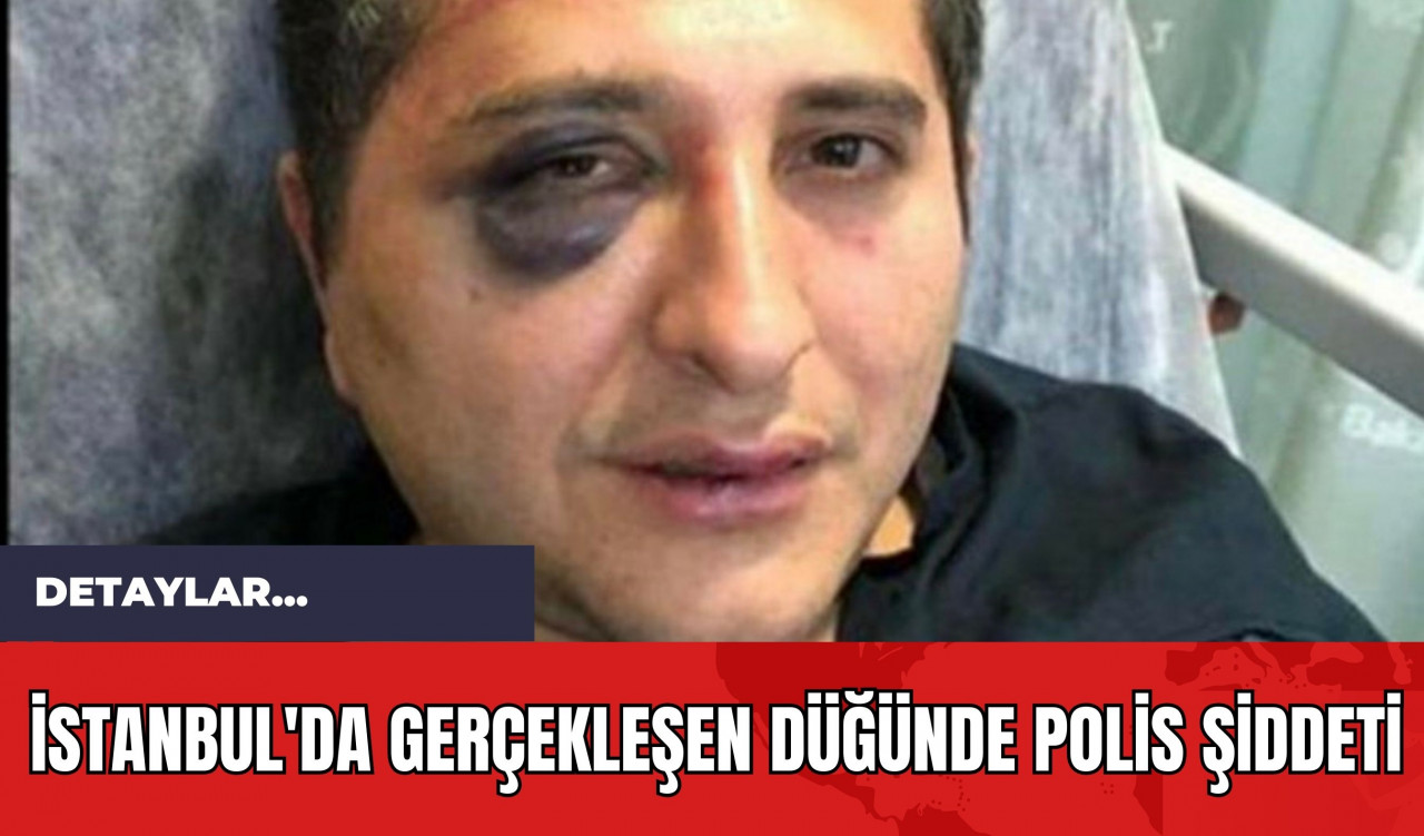 İstanbul'da Gerçekleşen Düğünde Polis Şiddeti!