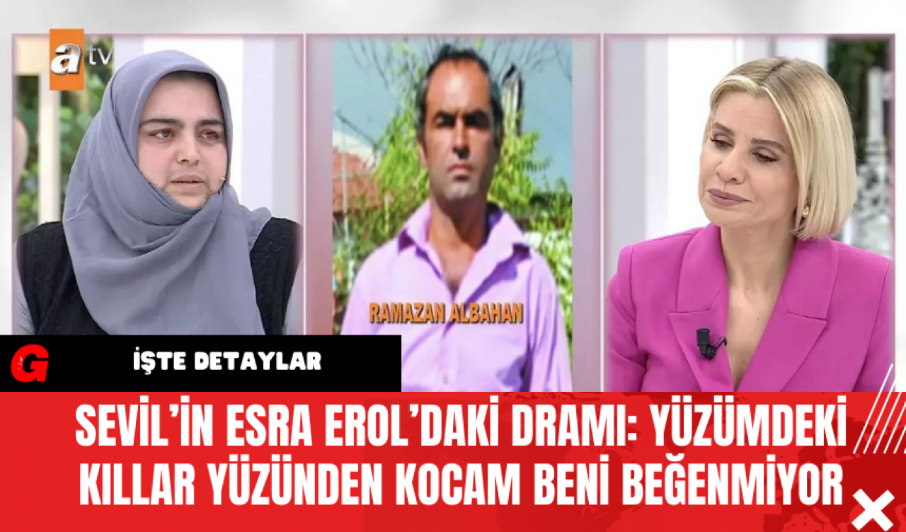 Sevil’in Esra Erol’daki Dramı: Yüzümdeki Kıllar Yüzünden Kocam Beni Beğenmiyor