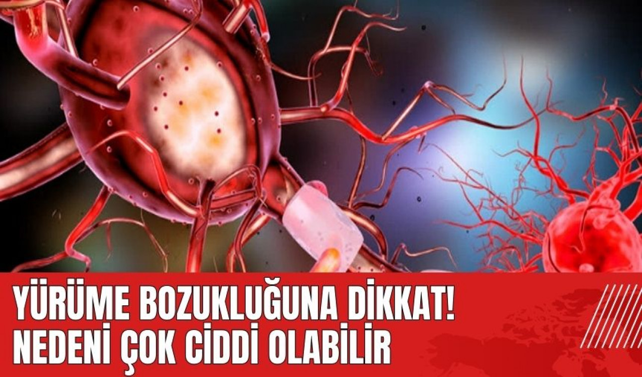 Yürüme bozukluğuna dikkat! Nedeni çok ciddi olabilir