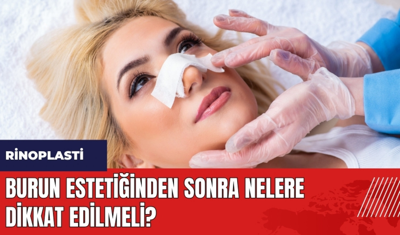 Burun estetiğinden sonra nelere dikkat edilmeli?