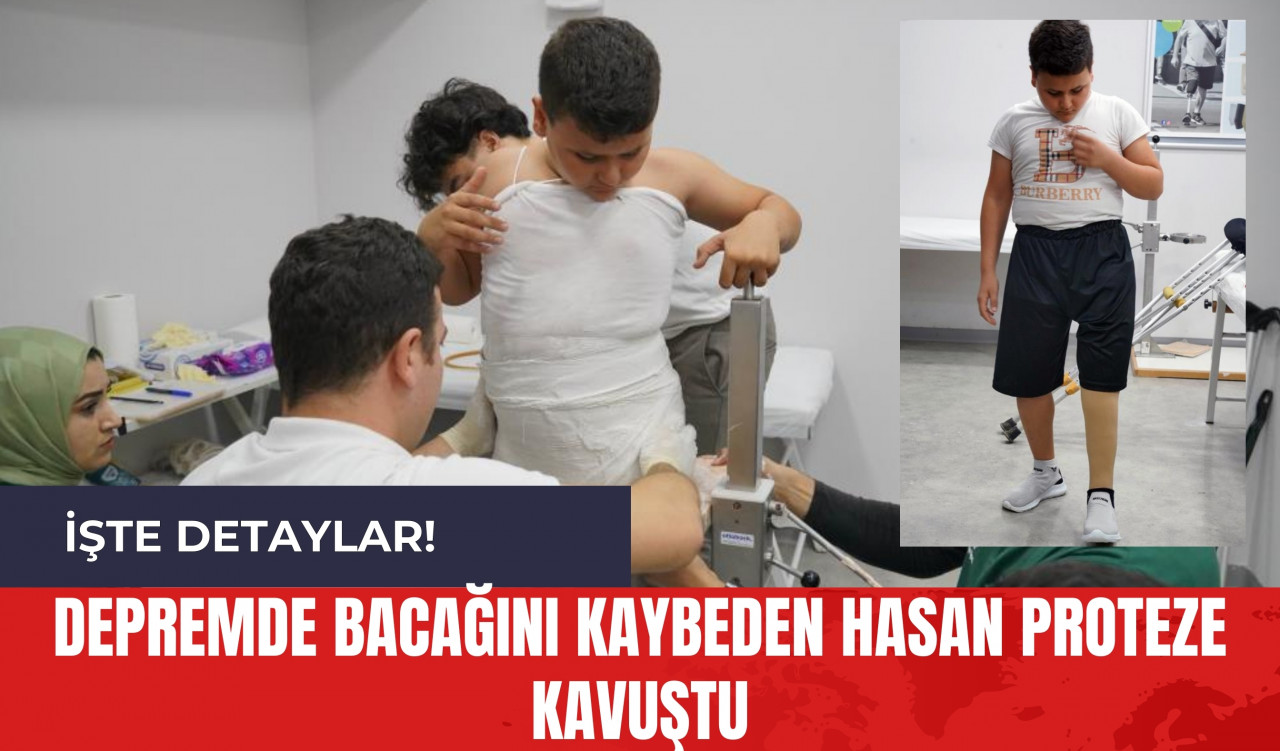 Depremde Bacağını Kaybeden Hasan Proteze Kavuştu