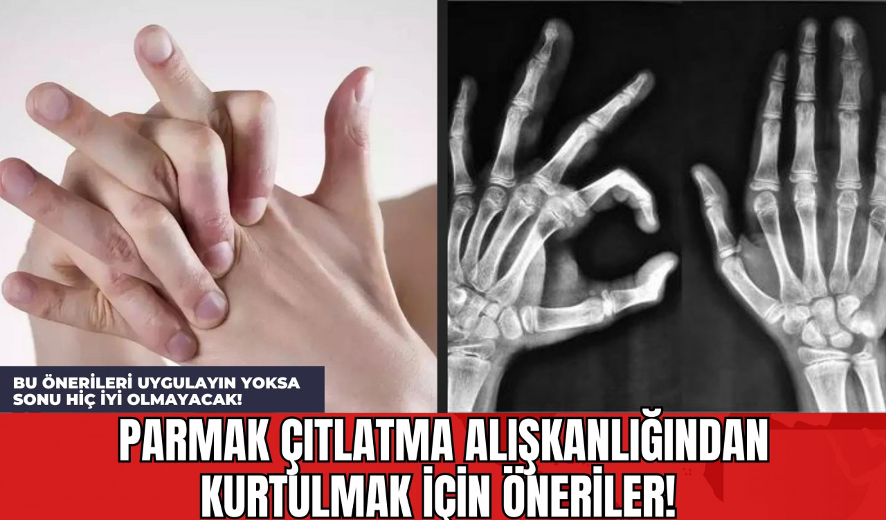 Parmak Çıtlatma Alışkanlığından Kurtulmak İçin Öneriler! Bu Önerileri Uygulayın Yoksa Sonu Hiç İyi Olmayacak!