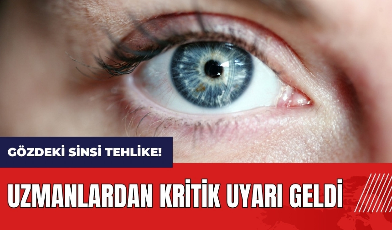 Gözdeki sinsi tehlike! Uzmanlardan kritik uyarı geldi