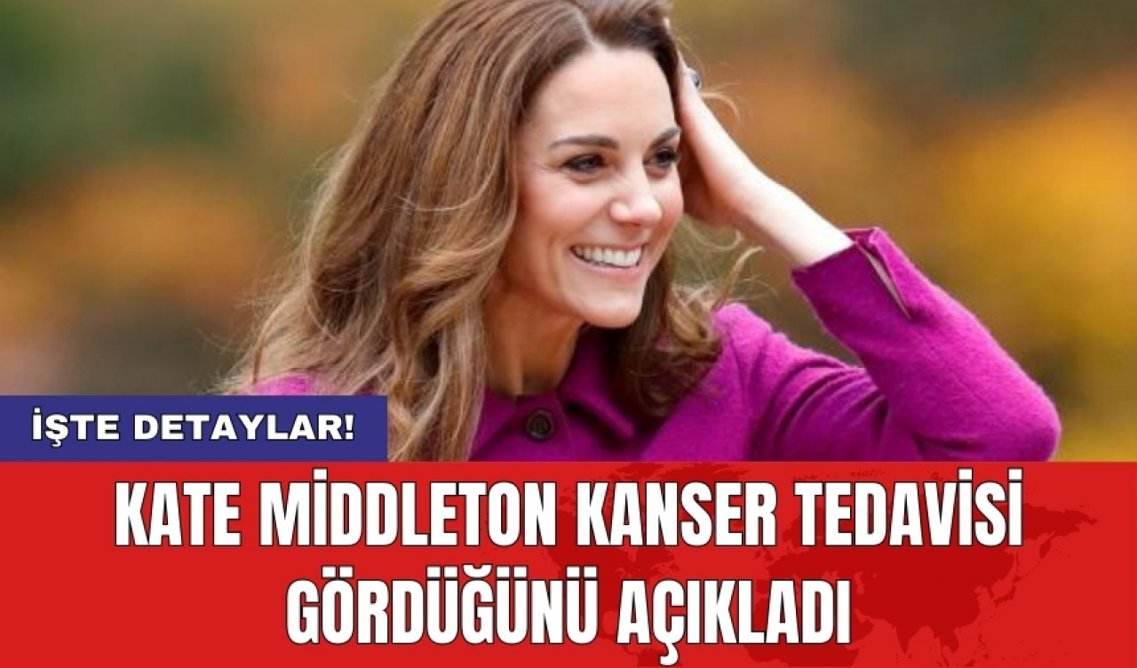 Kate Middleton kanser tedavisi gördüğünü açıkladı