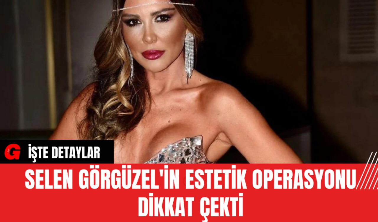 Selen Görgüzel'in Estetik Operasyonu Dikkat Çekti