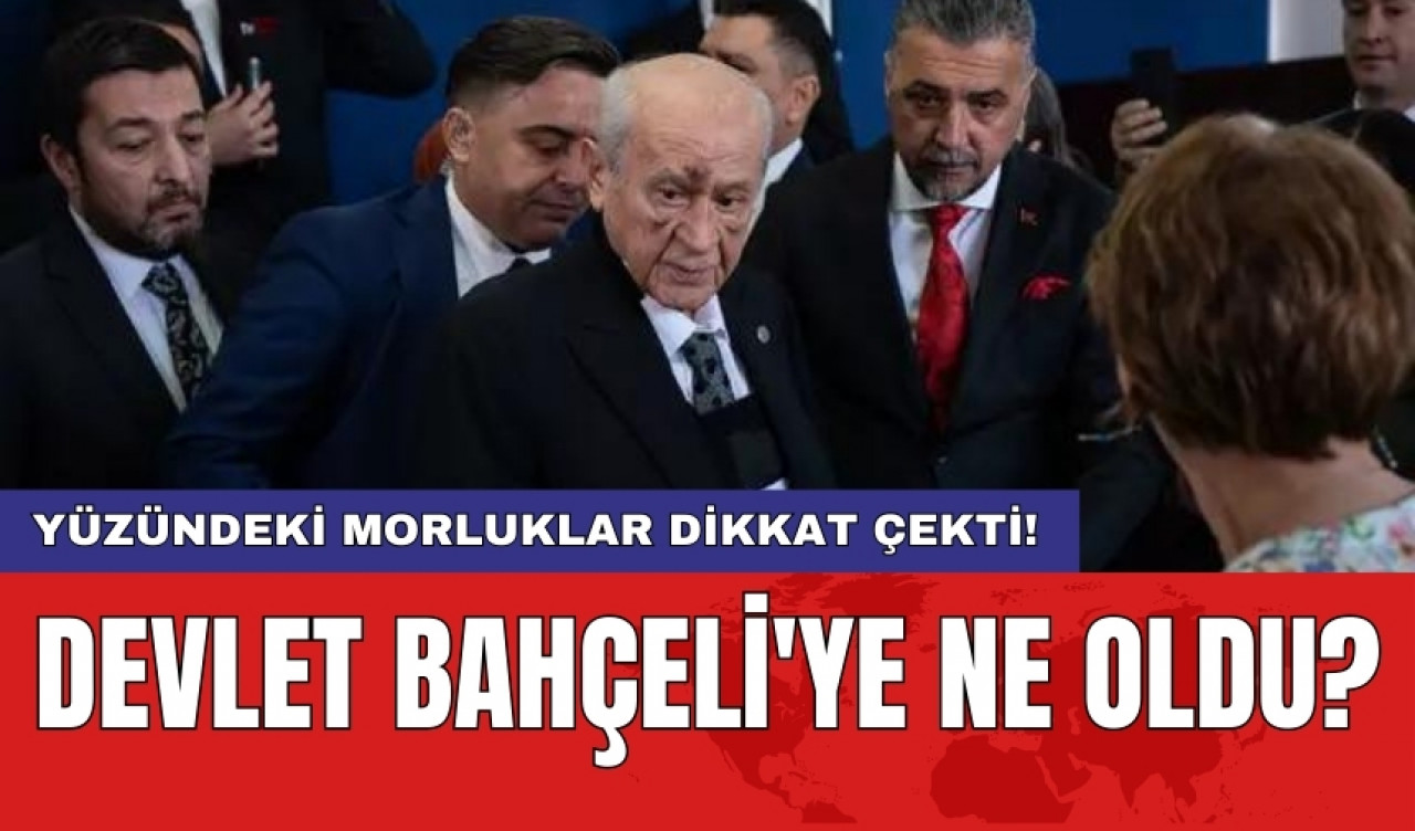 Yüzündeki morluklar dikkat çekti! Devlet Bahçeli'ye ne oldu?