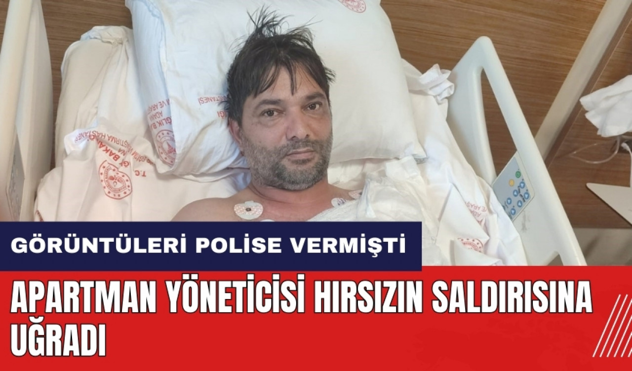 Adana'da görüntüleri polise veren yönetici hırsızın saldırısına uğradı