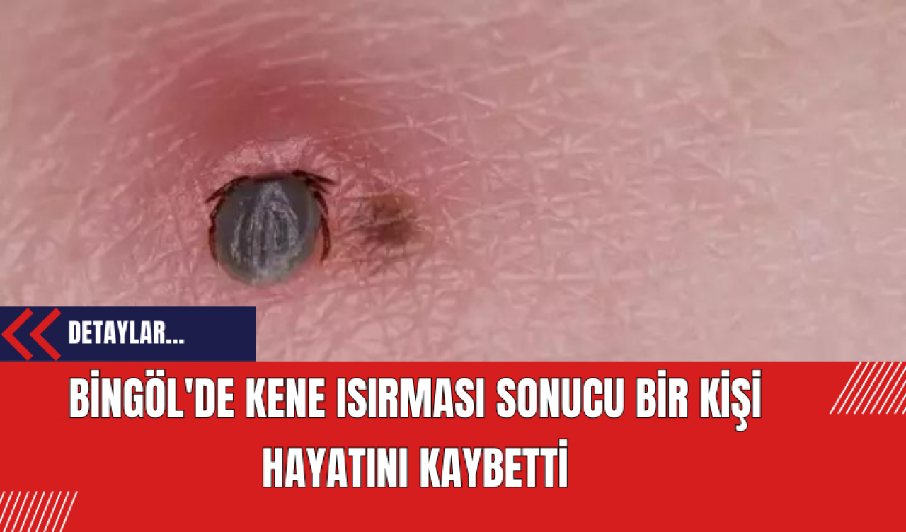 Bingöl'de Kene Isırması Sonucu Bir Kişi Hayatını Kaybetti