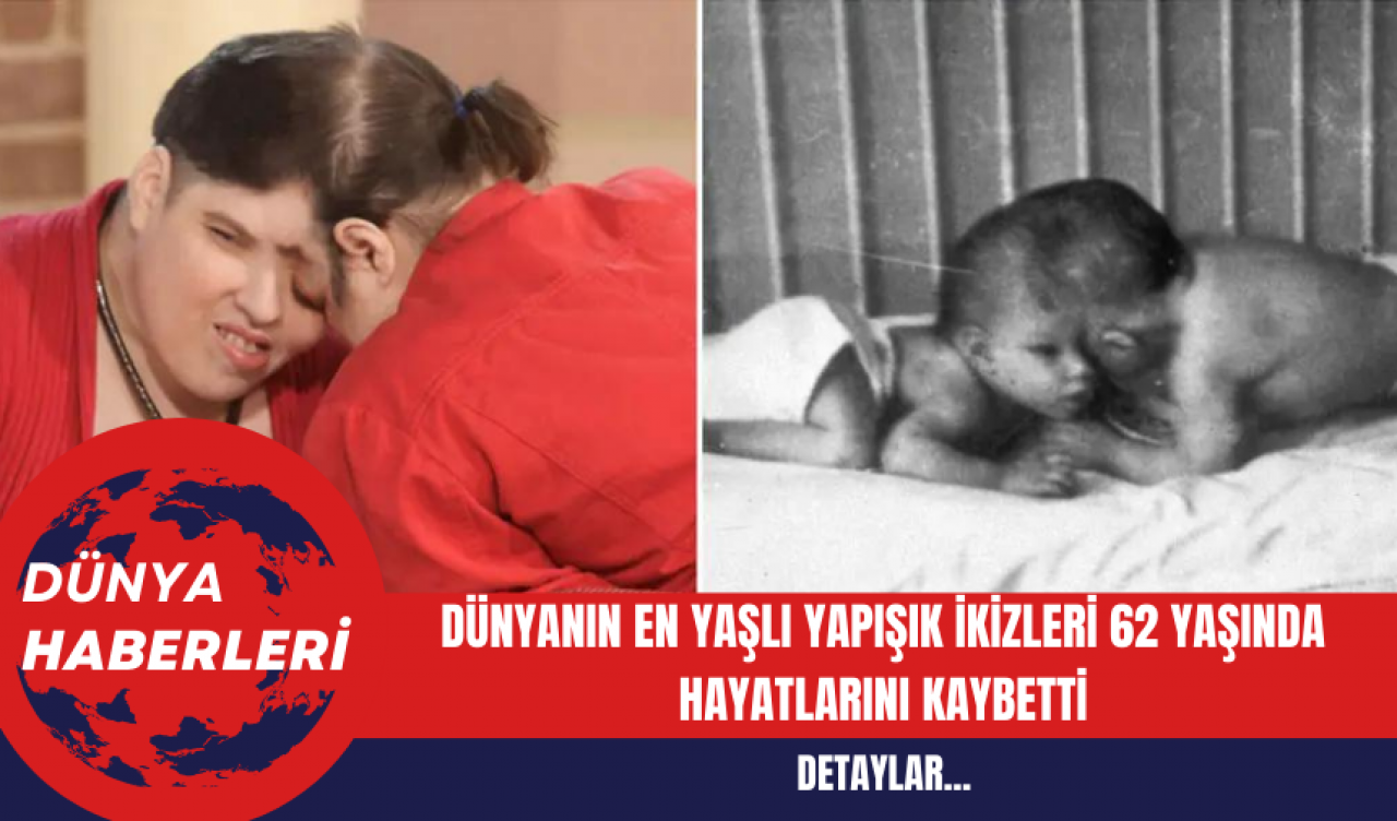 Dünyanın En Yaşlı Yapışık İkizleri 62 Yaşında Hayatlarını Kaybetti