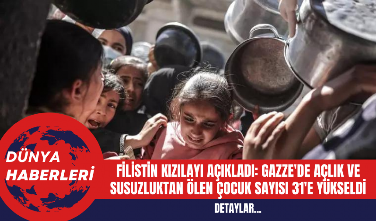 Filistin Kızılayı Açıkladı: Gazze'de Açlık ve Susuzluktan Ölen Çocuk Sayısı 31'e Yükseldi