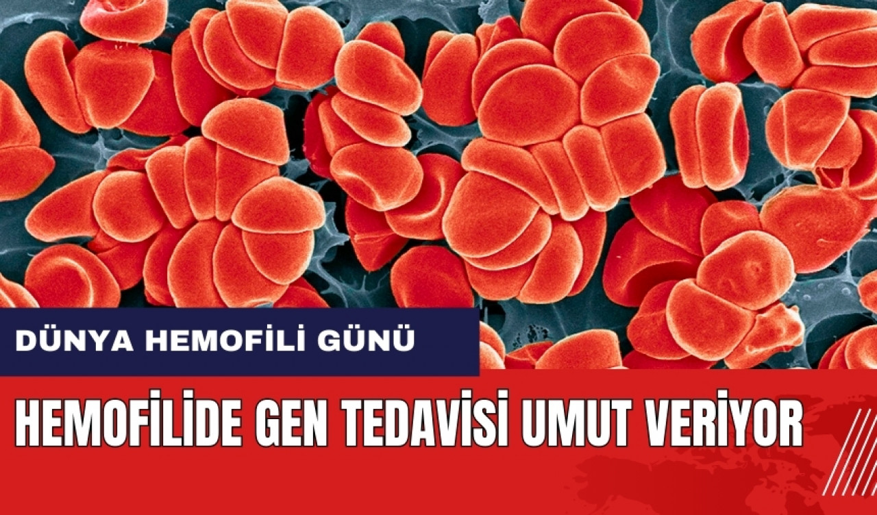 Hemofilide gen tedavisi umut veriyor