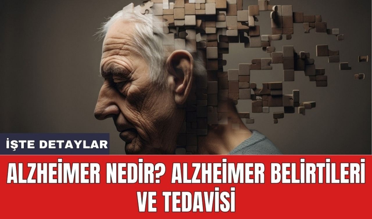 Alzheimer Nedir? Alzheimer Belirtileri ve Tedavisi