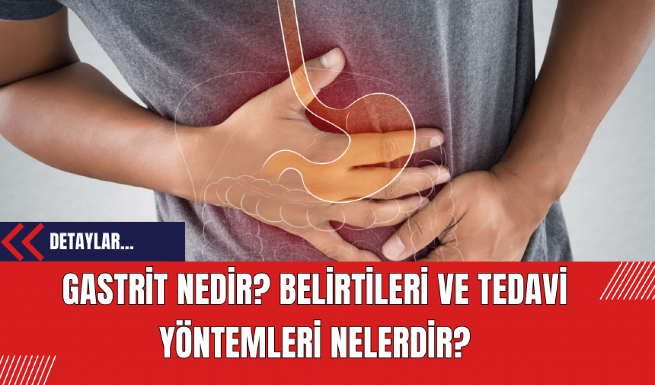 Gastrit Nedir? Belirtileri ve Tedavi Yöntemleri Nelerdir?