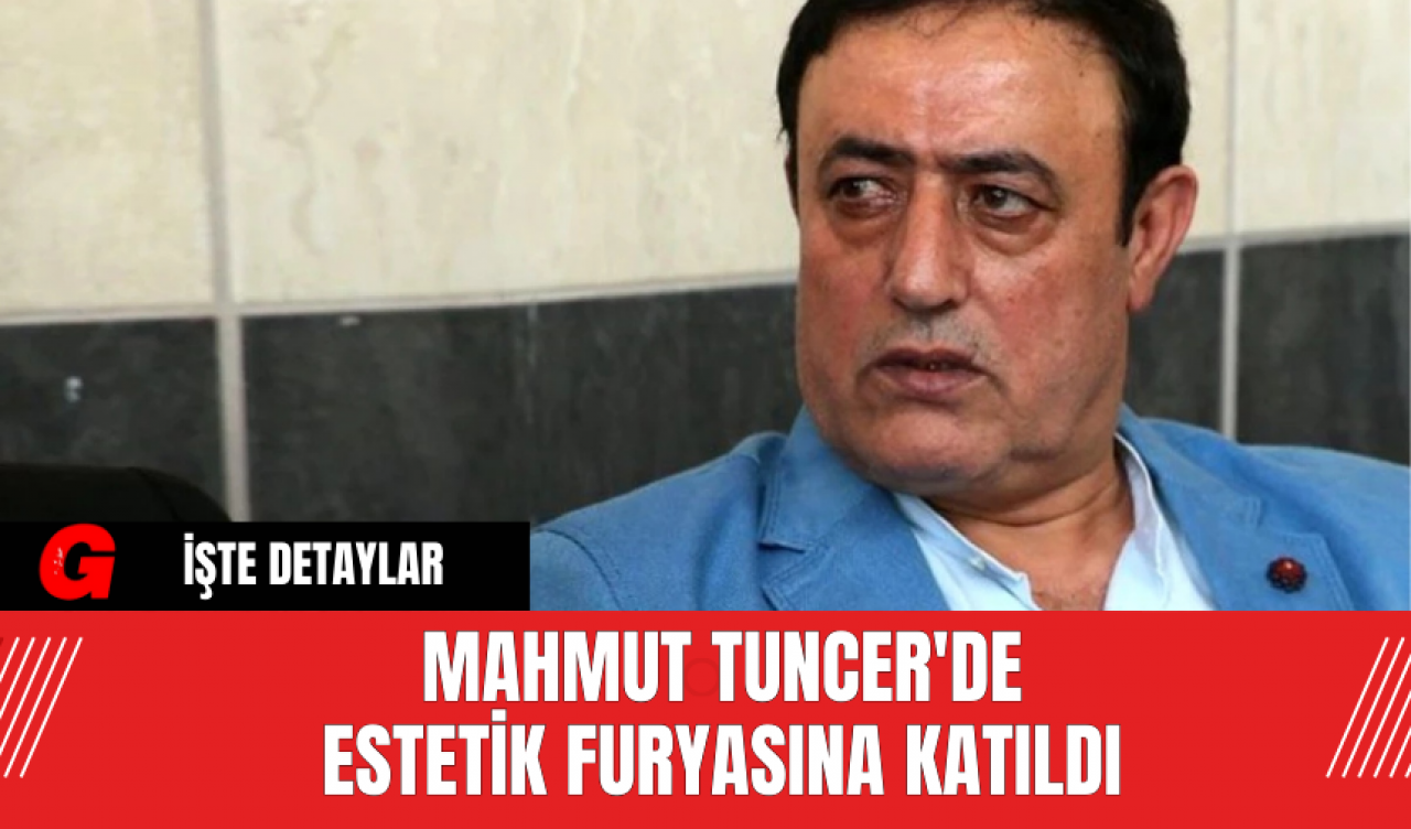 Mahmut Tuncer'de estetik furyasına katıldı