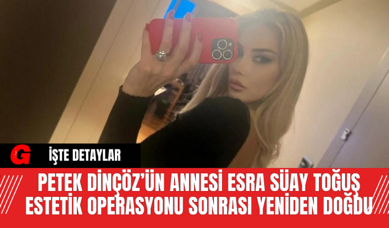 Petek Dinçöz’ün Annesi Esra Süay Toğuş Estetik Operasyonu Sonrası Yeniden Doğdu