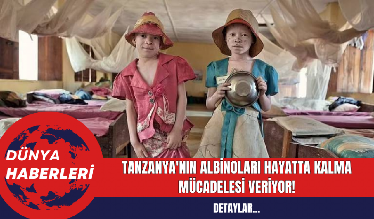 Tanzanya'nın Albinoları Hayatta Kalma Mücadelesi Veriyor!