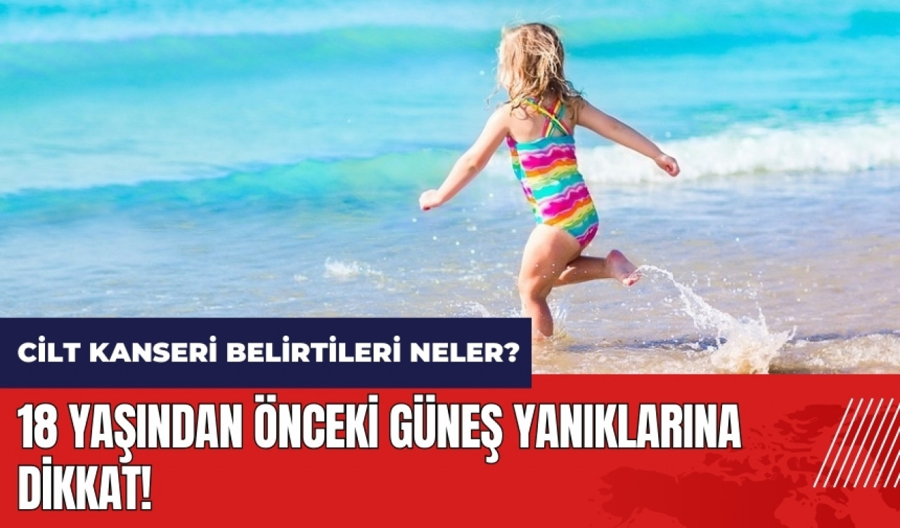 18 yaşından önceki güneş yanıklarına dikkat! Cilt kanseri belirtileri neler?