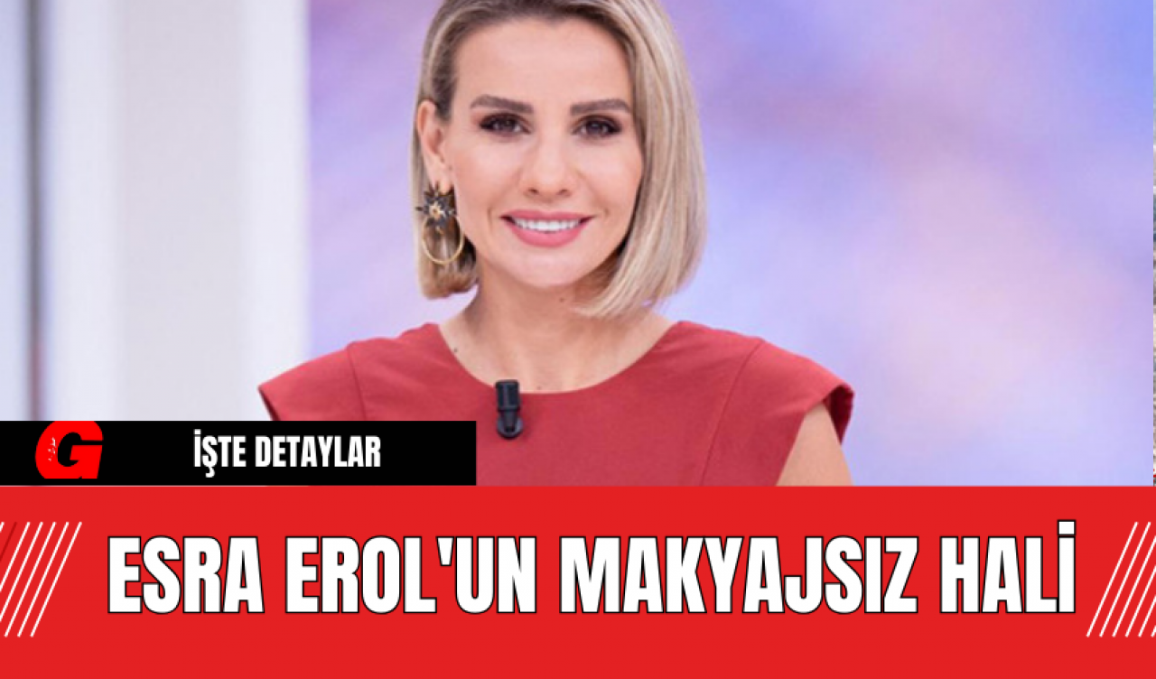 Esra Erol'un Makyajsız Hali