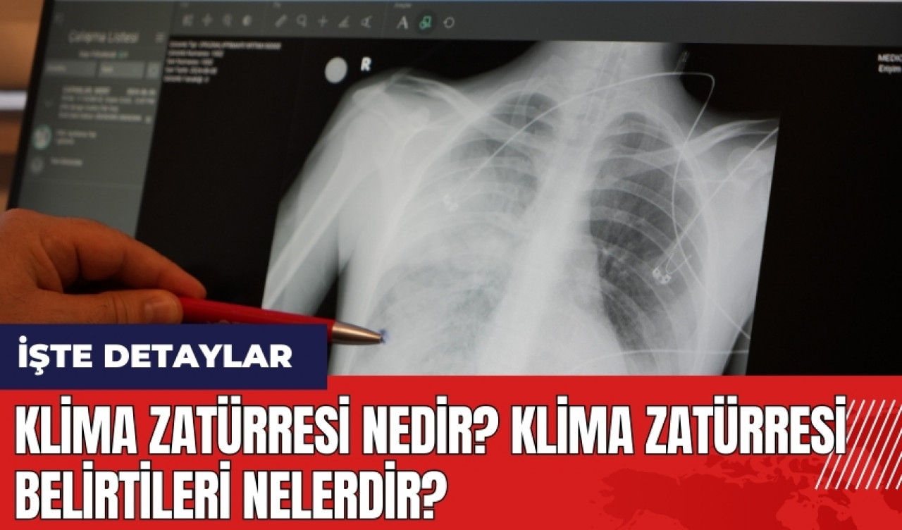 Klima zatürresi nedir? Klima zatürresi belirtileri nelerdir?