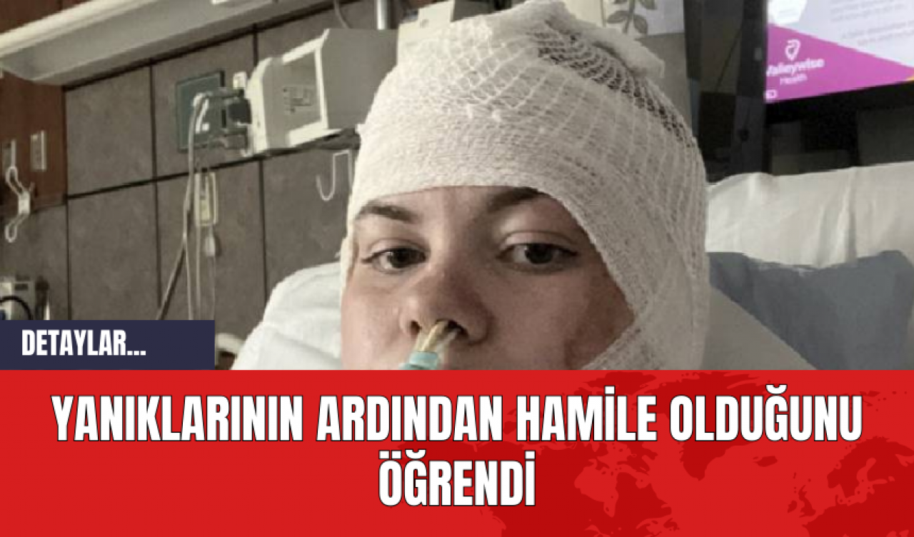 Yanıklarının Ardından Hamile Olduğunu Öğrendi