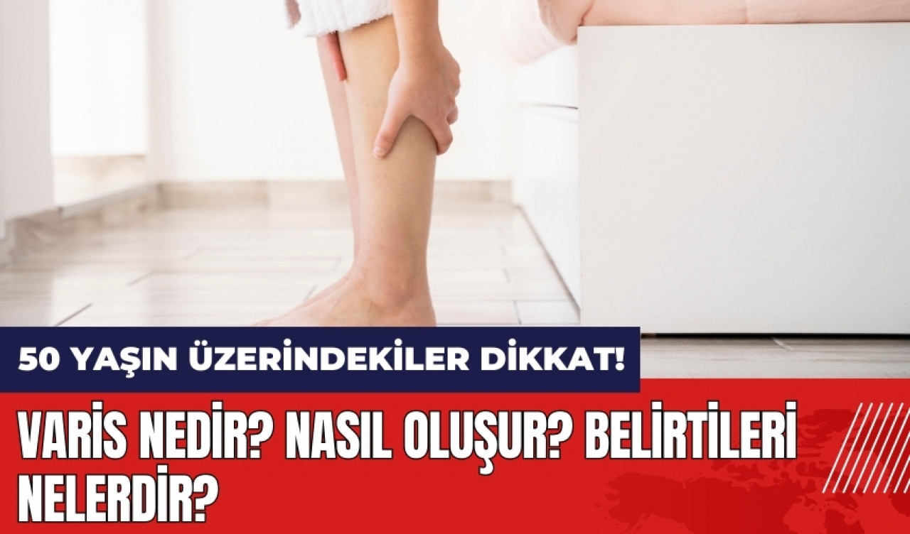 50 yaşın üzerindekiler dikkat! Varis nedir? Nasıl oluşur? Belirtileri nelerdir?