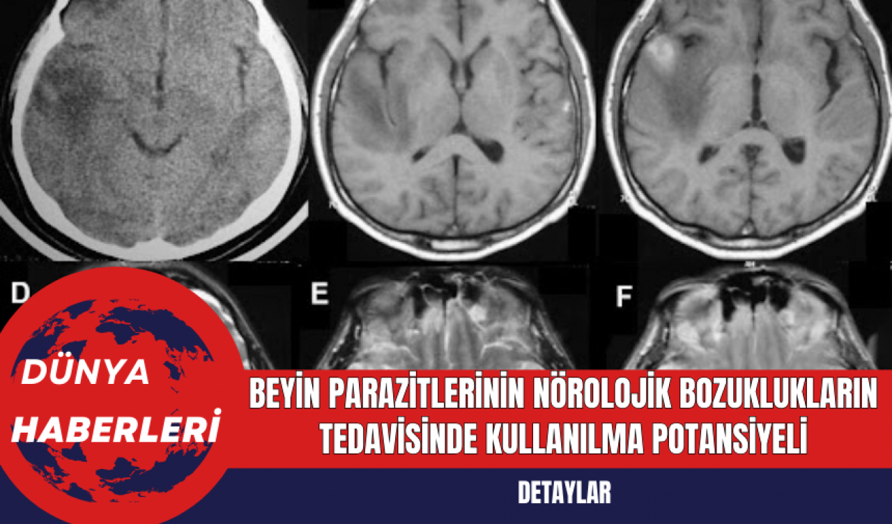 Beyin Parazitlerinin Nörolojik Bozuklukların Tedavisinde Kullanılma Potansiyeli