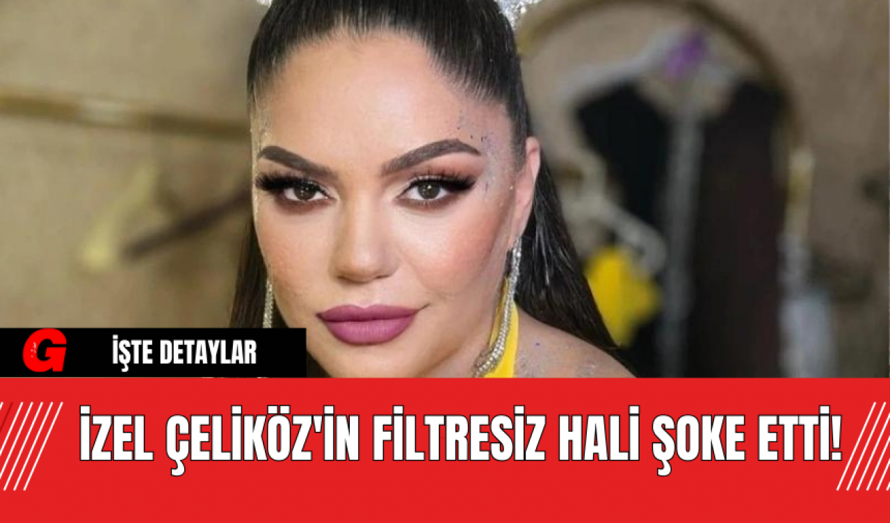 İzel Çeliköz'in Filtresiz Hali Şoke Etti!