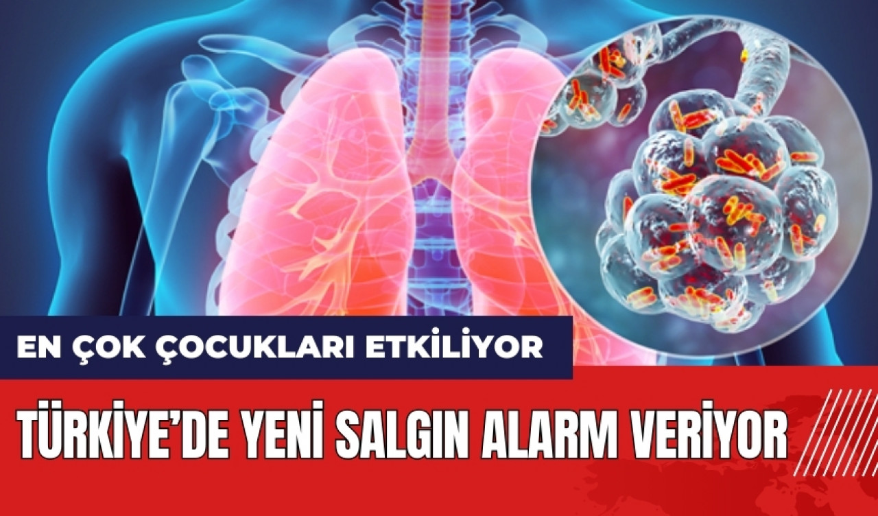 Türkiye’de yeni salgın alarm veriyor! En çok çocukları etkiliyor