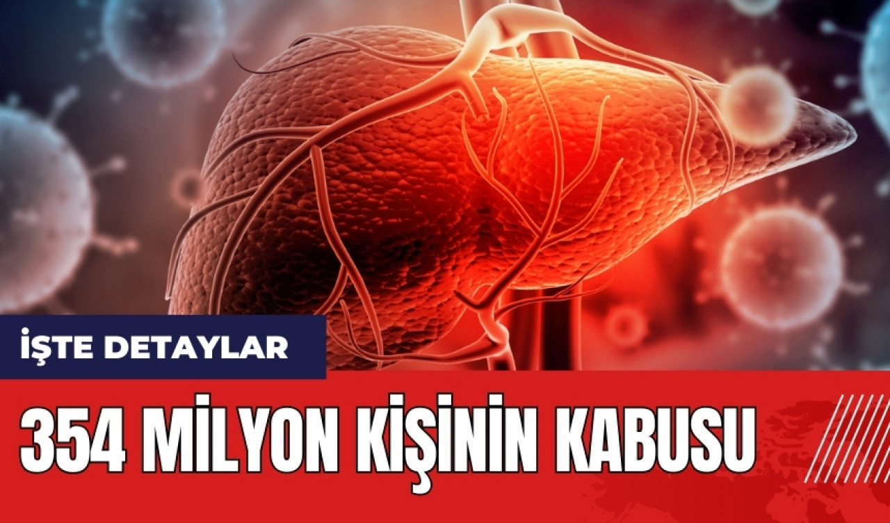 354 milyon kişinin kabusu