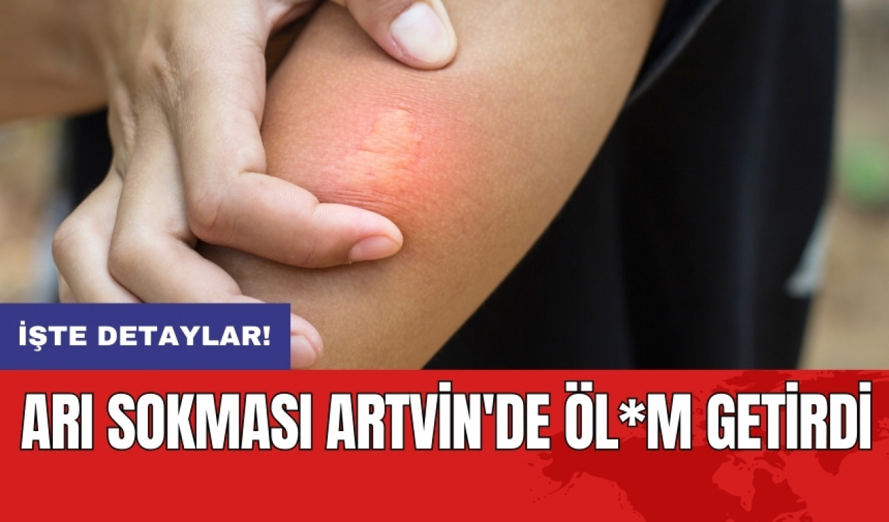 Arı sokması Artvin'de öl*m getirdi