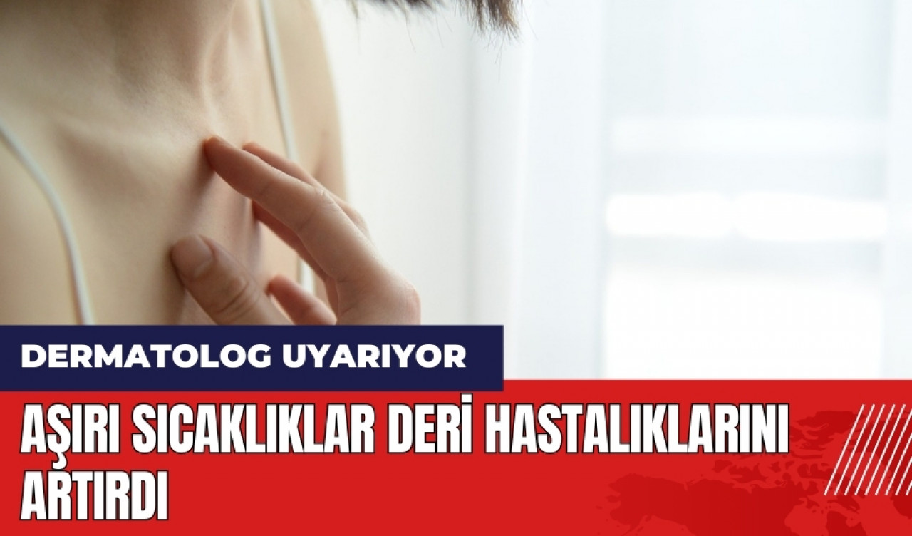 Aşırı sıcaklıklar deri hastalıklarını artırdı