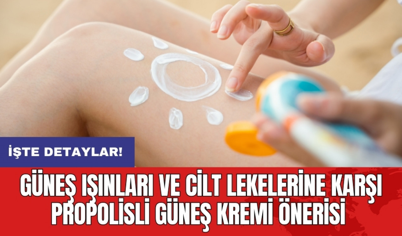 Güneş ışınları ve cilt lekelerine karşı propolisli güneş kremi önerisi