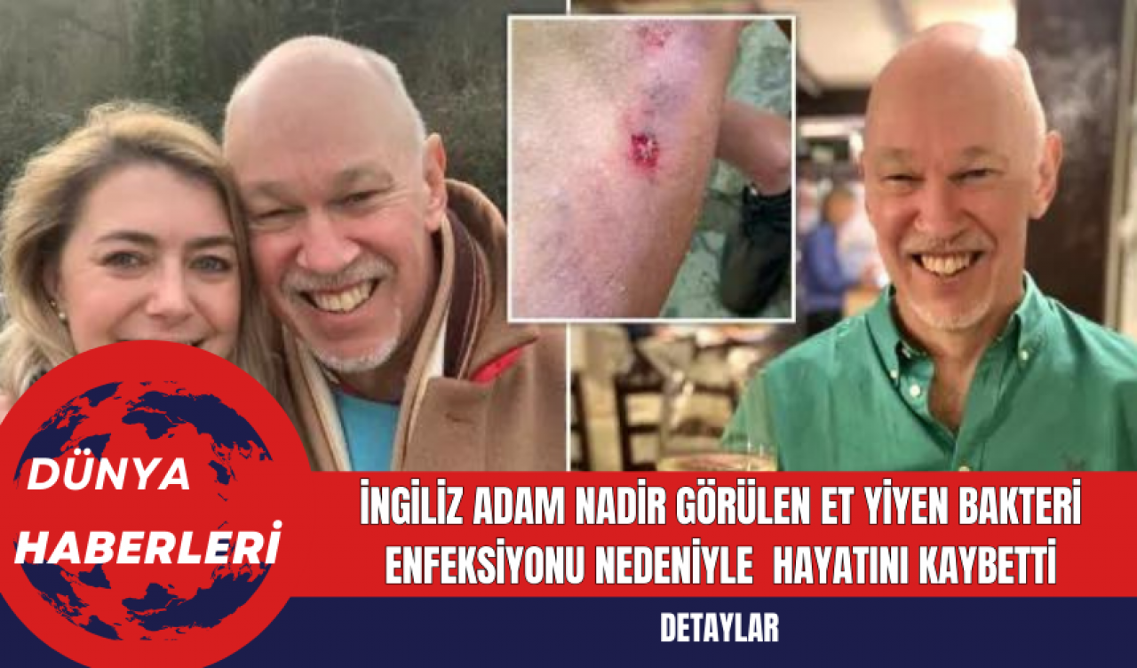 İngiliz Adam Nadir Görülen Et Yiyen Bakteri  Enfeksiyonu Nedeniyle Hayatını Kaybetti