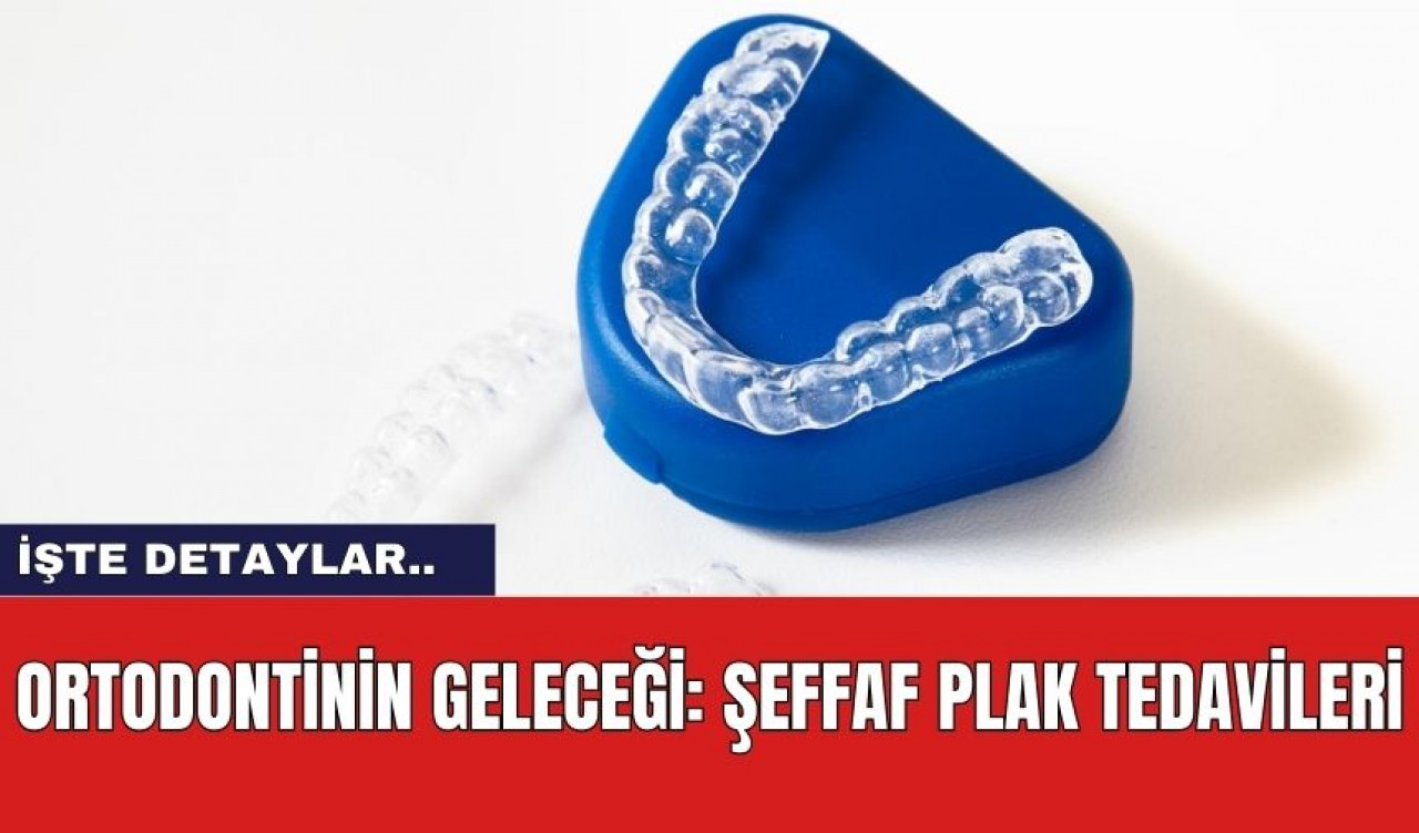 Ortodontinin Geleceği: Şeffaf Plak Tedavileri