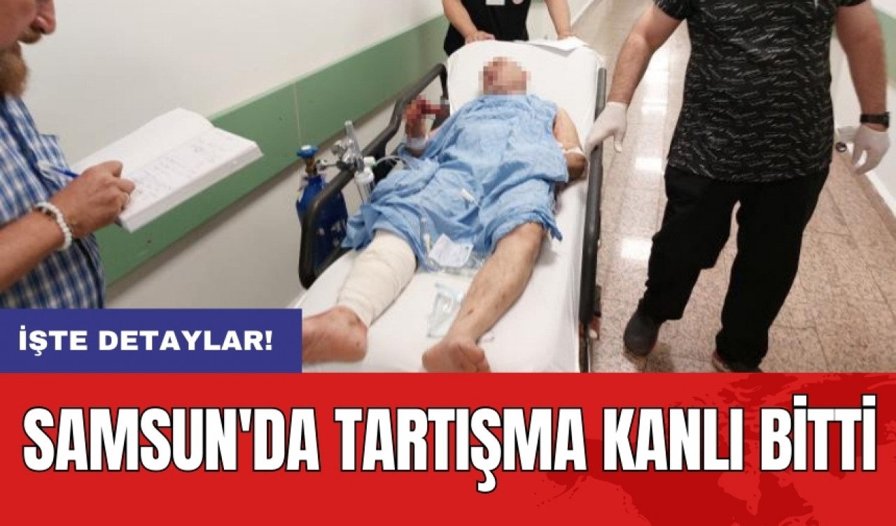 Samsun'da tartışma kanlı bitti