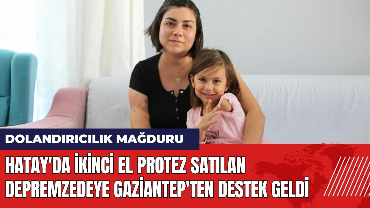 İkinci el protez satılan depremzedeye Gaziantep'ten destek geldi