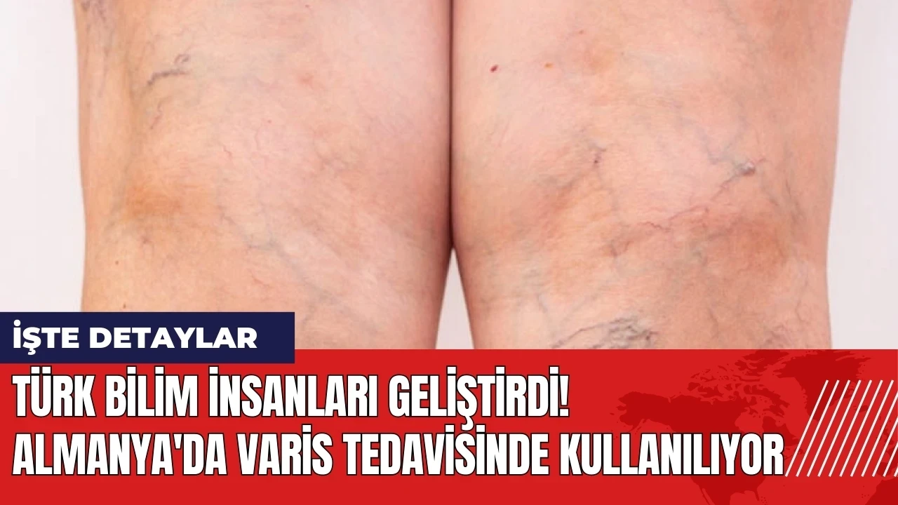 Türk bilim insanları geliştirdi! Almanya'da varis tedavisinde kullanılıyor