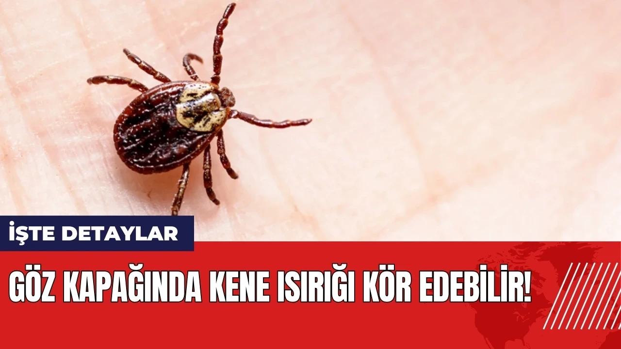 Göz kapağında kene ısırığı kör edebilir!