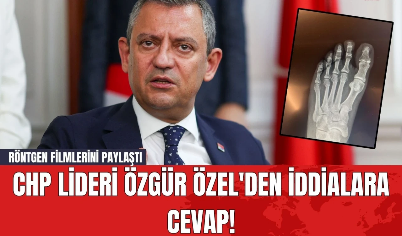 CHP Lideri Özgür Özel'den İddialara Cevap! Röntgen Filmlerini Paylaştı