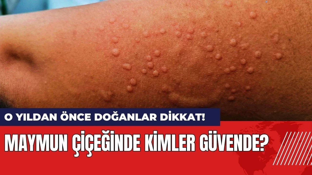 Maymun çiçeğinde kimler güvende? O yıldan önce doğanlar dikkat!