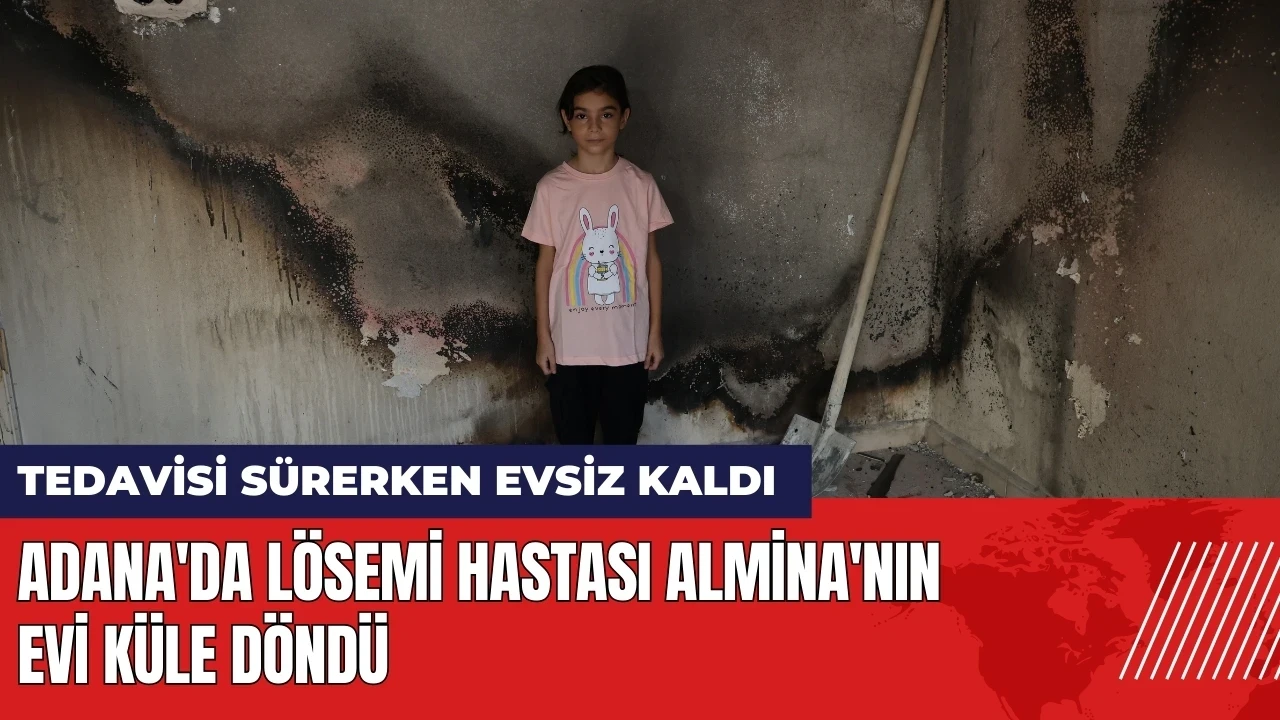 Adana'da lösemi hastası küçük Almina'nın evi yandı