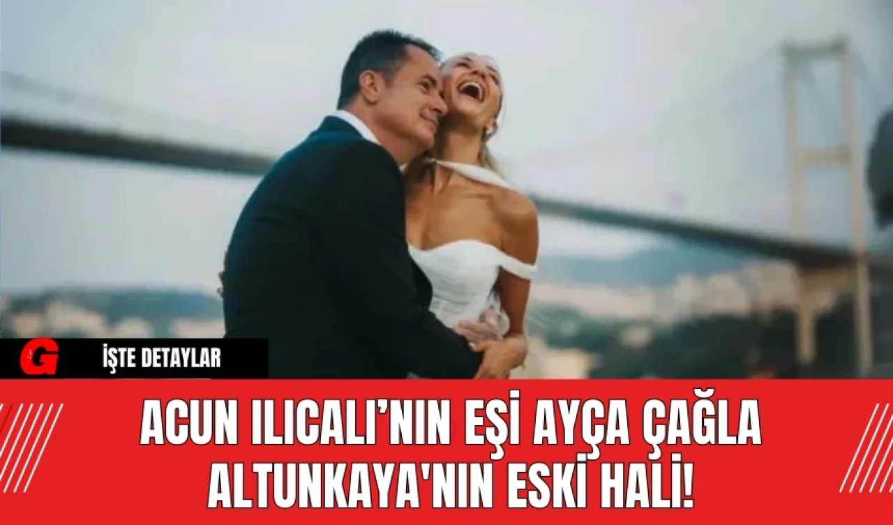 Acun Ilıcalı’nın Eşi Ayça Çağla Altunkaya'nın Eski Hali!